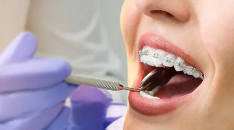 Melbourne Orthodontist